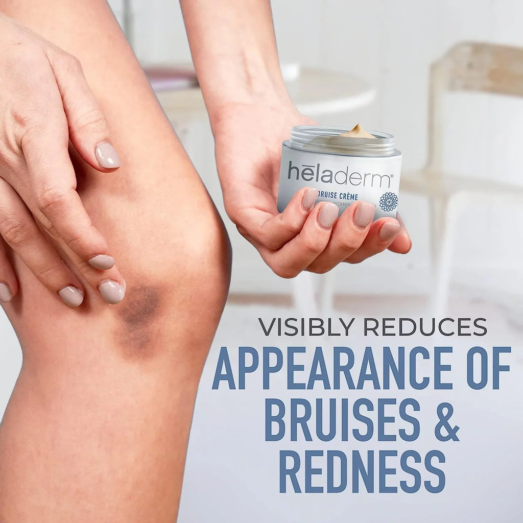 Heladerm Arnica Oil Bruise Cream, Fast Healing, Rejuvenates Skin, Bruise and Swelling Skincare, 1.7 oz